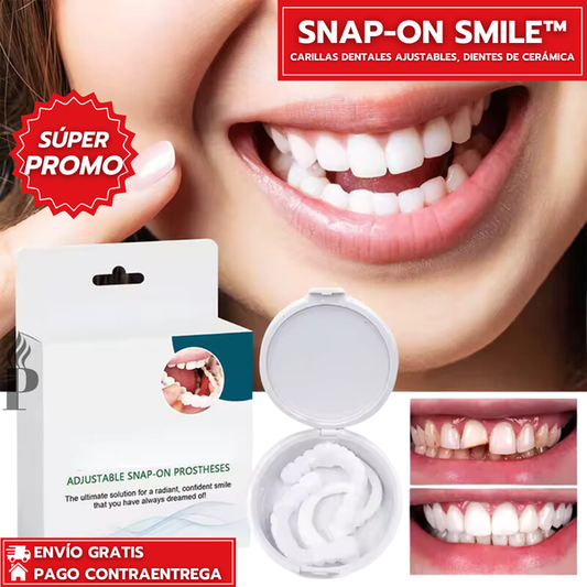 Snap-On Smile™: Carillas Dentales Ajustables